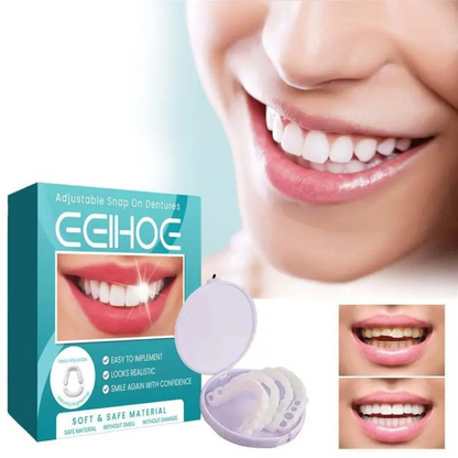 BluetPop Carillas Dentales – Sonríe con Confianza al Instante!